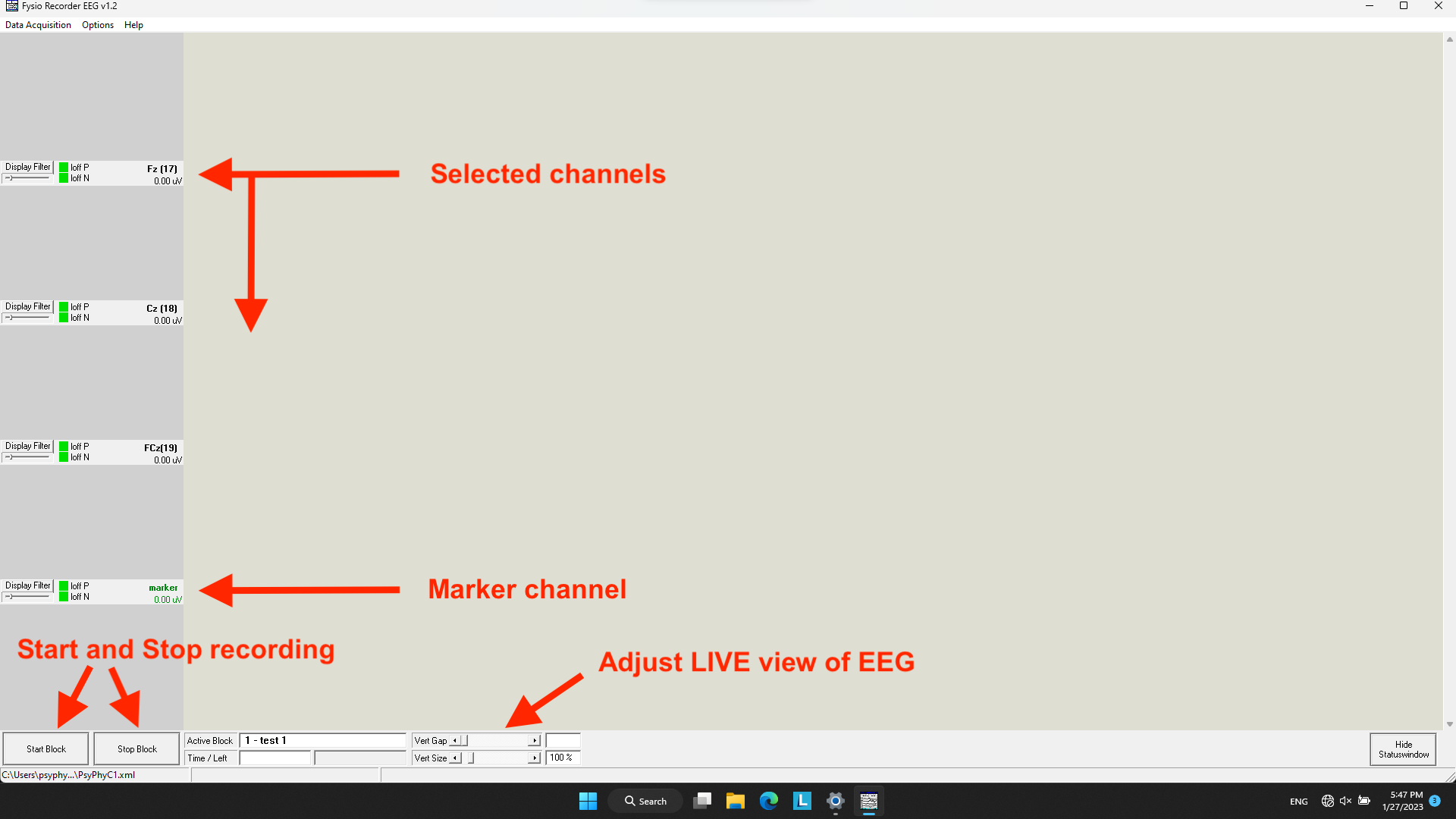 recorder overview